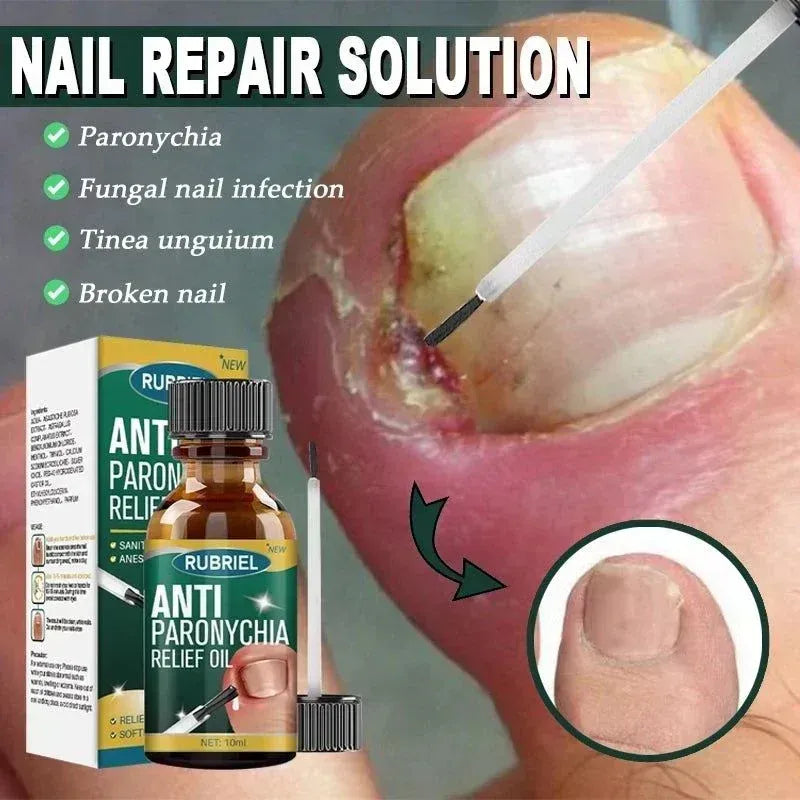 Anti Paronychia Relief Oil- Buy 1 Get 1 Free