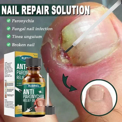 Anti Paronychia Relief Oil- Buy 1 Get 1 Free!!!